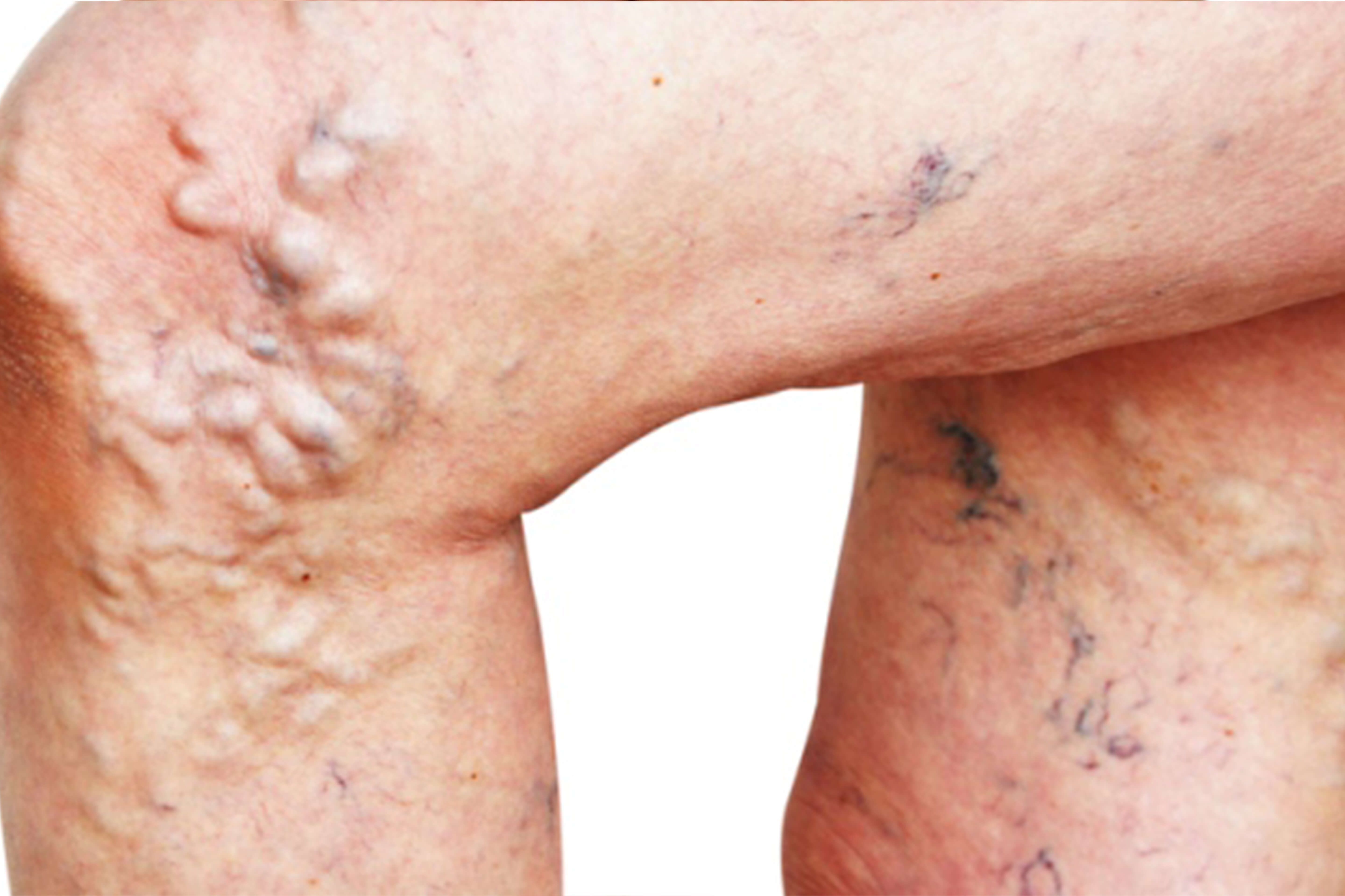 Imagine Chirurgie Vasculara